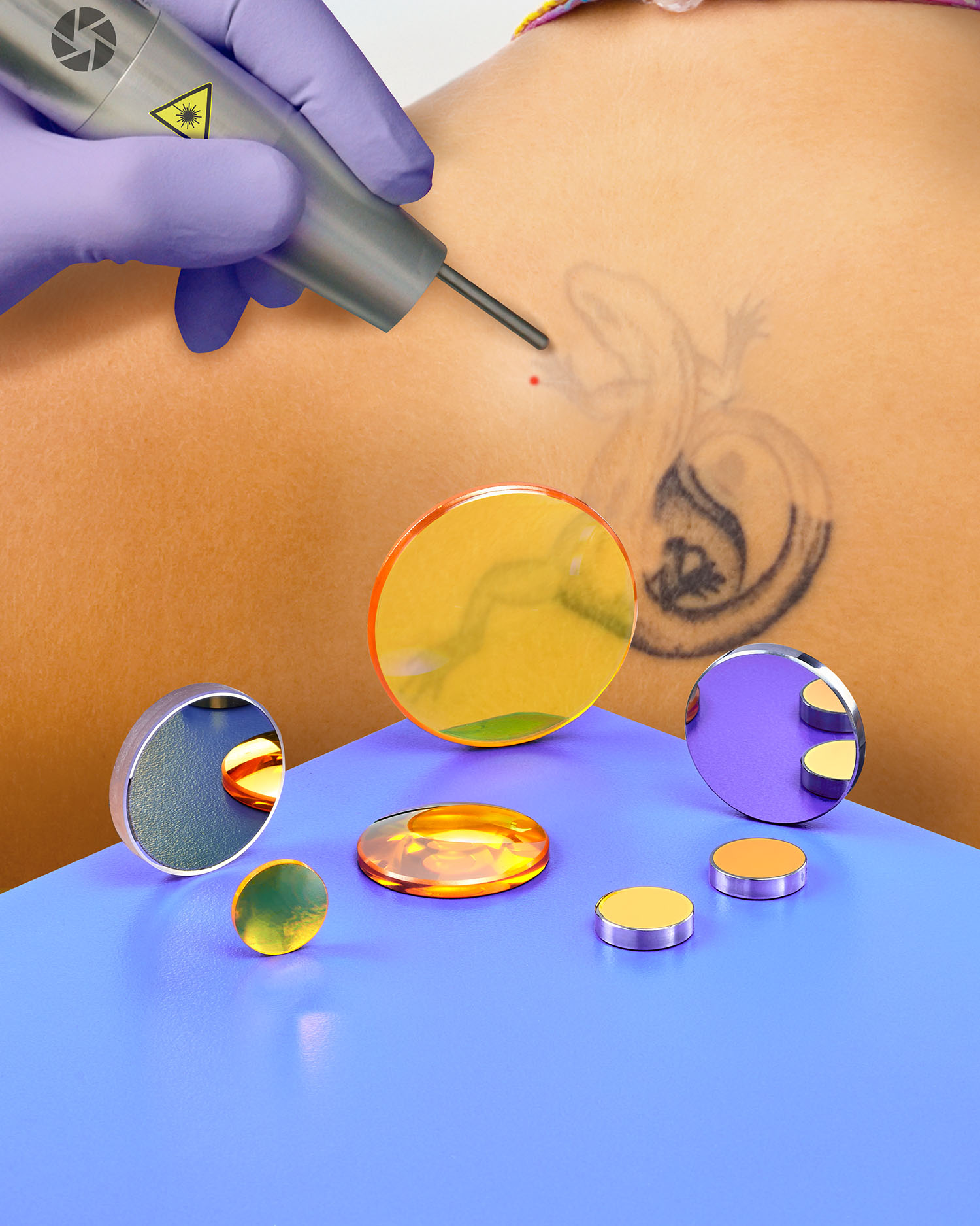 TattooMedics Laser Tattoo Removal  Providence RI