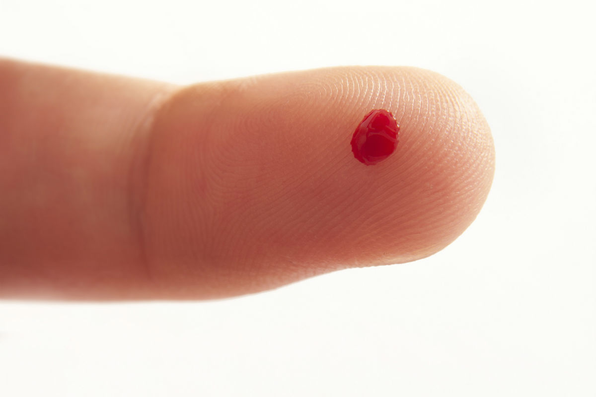 Blood Test Results Vary From Drop To Drop In Finger Prick Tests 