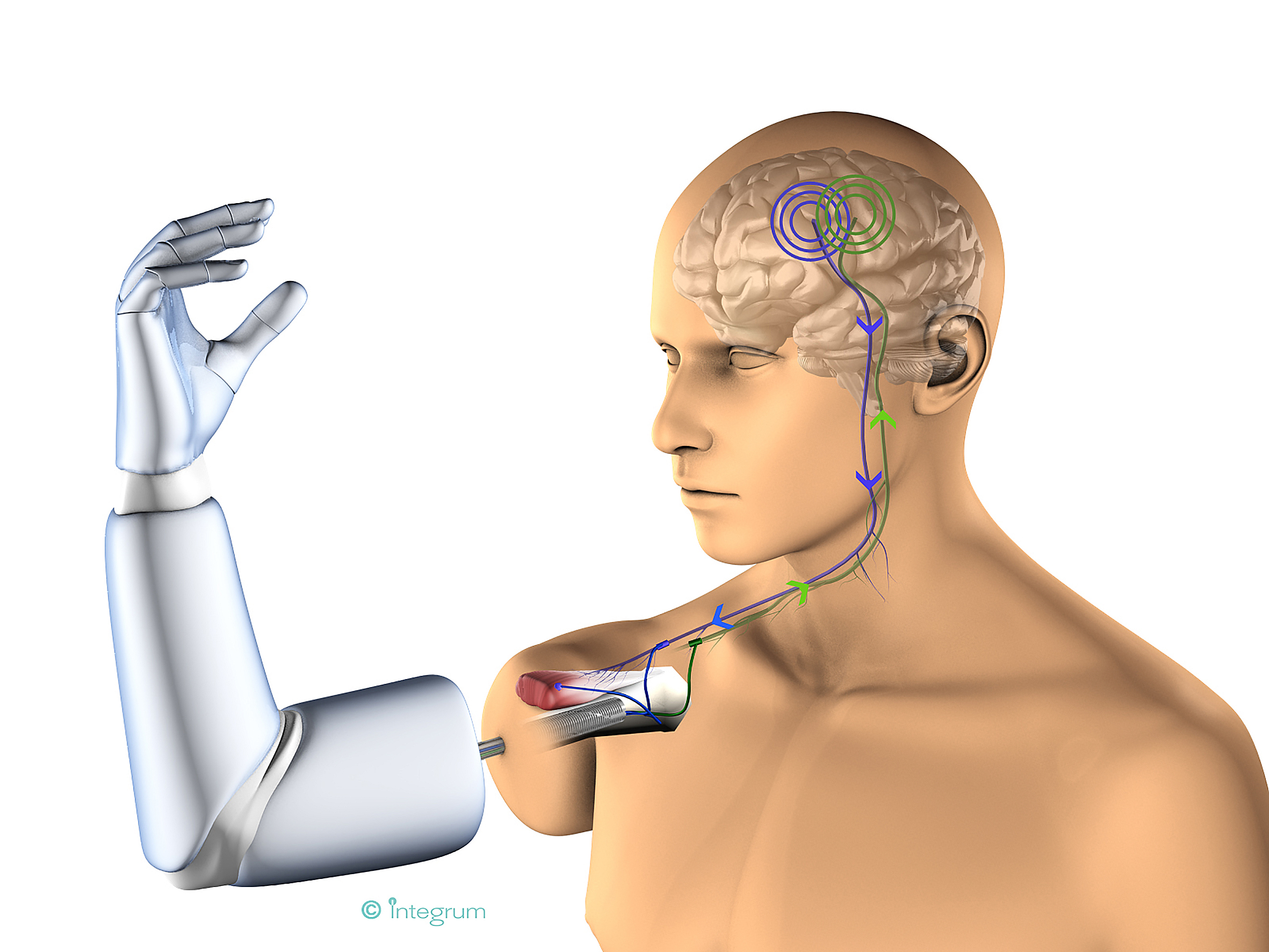 Управление импульс мозга. Протезы управляемые мозгом. Протезы с биоэлектрическим управлением. Биомеханический протез руки. Протез управляемый силой мысли.