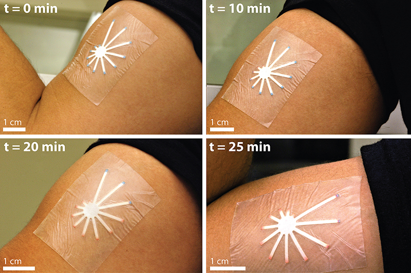 Low-Cost Paper-Based Skin Patch Monitors Dehydration by Changing Color ...