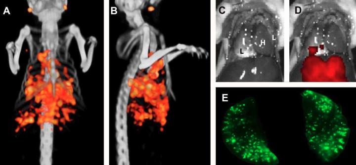 SPECT/CT Combined with Fluorescence Imaging Detects Micrometastases ...