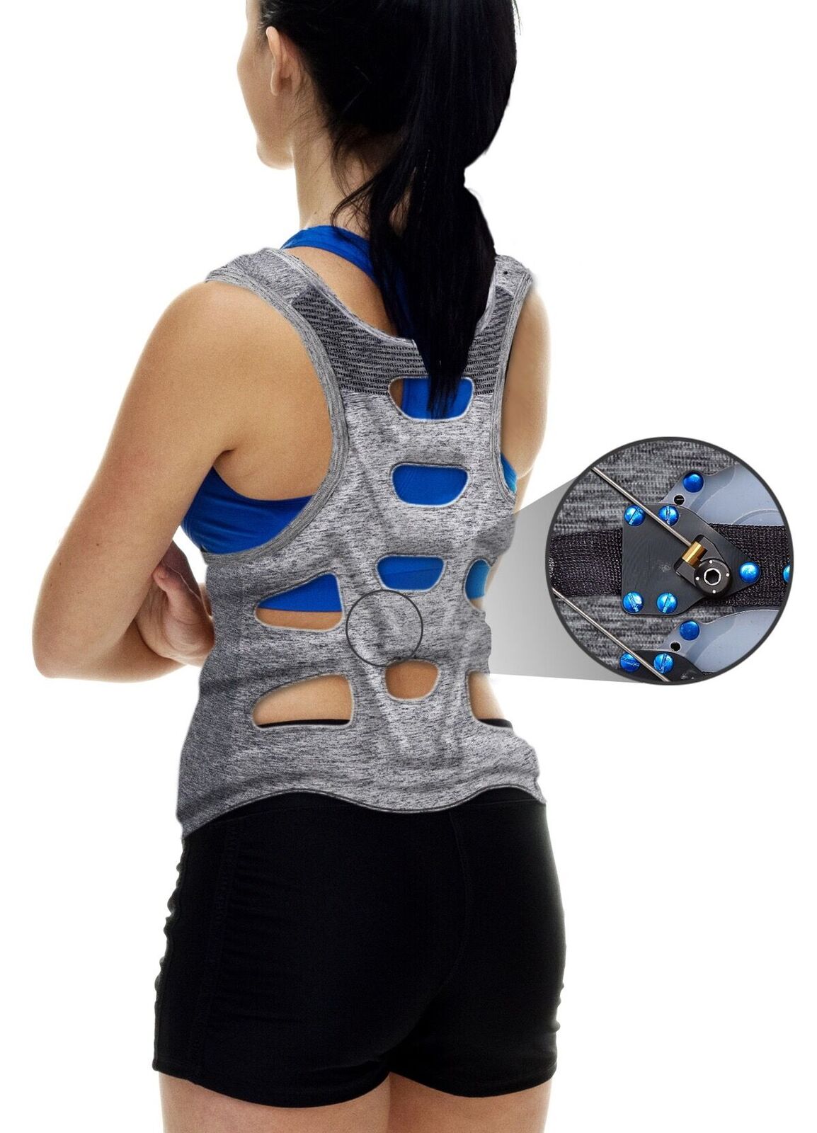 Scoliosis Brace Awarded $50,000 from FDA-Sponsored Competition