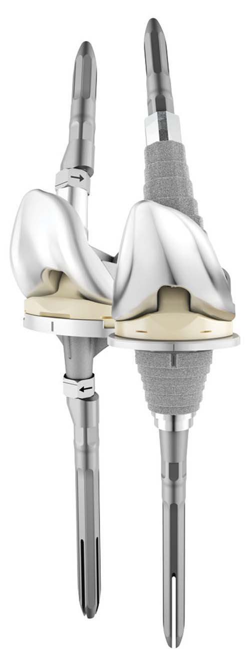 DePuy Synthes Launches New ATTUNE Revision Knee System - Medical Design ...