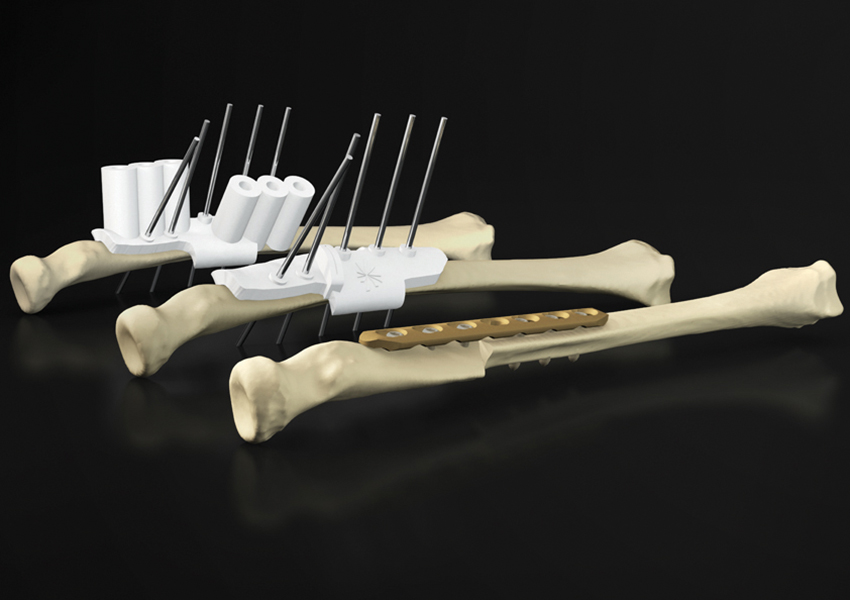 Fit To Print: The Future Of Orthopedic Surgery Will Come Out Of A 3D Printer - Medical Design and Outsourcing